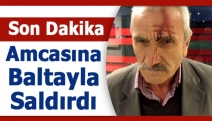 Amcasına baltayla saldırdı