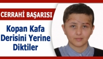 Cerrahi Başarısı, Kopan kafa derisini yerine diktiler