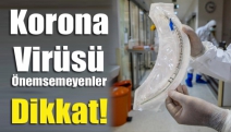 Korona Virüsü Önemsemeyenler Dikkat!